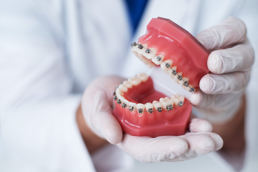 Closeup of an orthodontist holding a gums and teeth model with braces