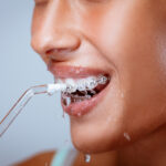 clean teeth with braces, water flosser, waterpik