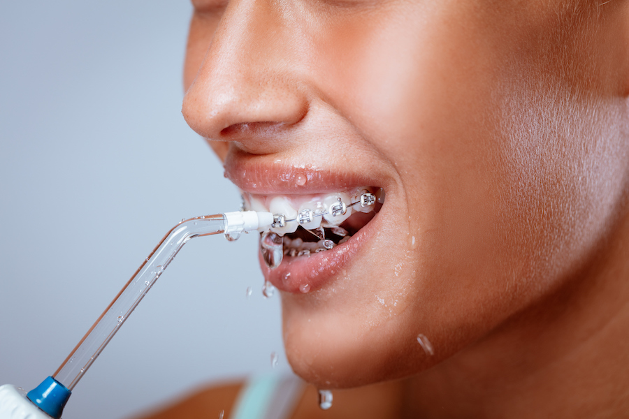 clean teeth with braces, water flosser, waterpik